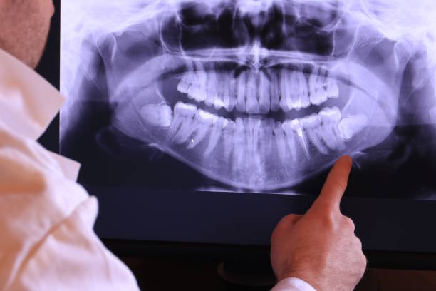 Best Broken or Cracked Tooth Emergency Dentist in Unionville, GA